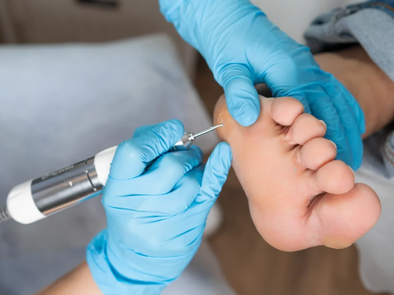 Diabetes and Diabetic Foot Care